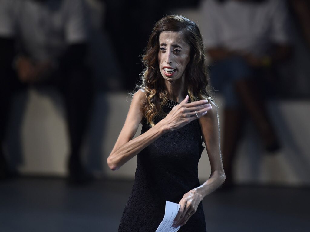 Lizzie Velasquez: How the activist named 'world's ugliest woman' tackled trolls by launching a global campaign | The Independent | The Independent